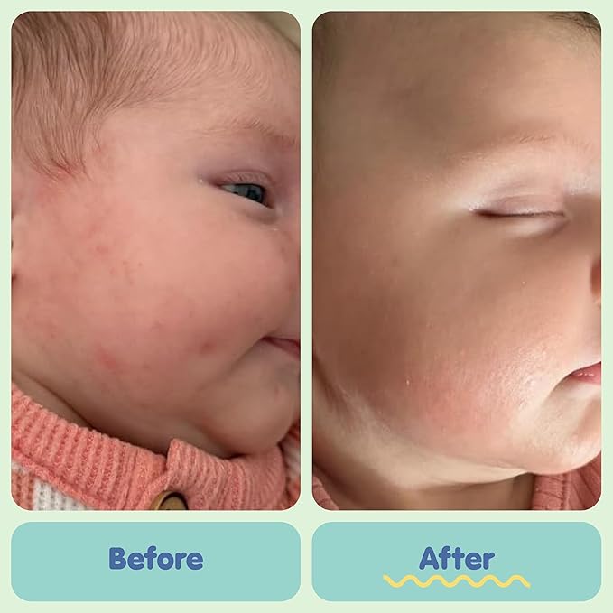 TUBBY TODD All Over Ointment - Baby Eczema Cream, Everyday Multi-Purpose Sensitive, Dry, Irritation Baby Skin Relief Cream, Steroid & Gluten Free, Fragrance Free, 3.5 oz & 8oz, 2 Pack