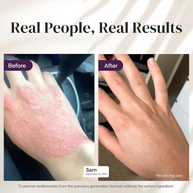 Puriya 5-in-1 Eczema Cream for Kids, Baby, Toddler, Adults, Advanced Colloidal Oatmeal Lotion for Dry, Itchy Skin Relief on Face and Body, Clinically Tested, Intensive Moisturizing Eczema Treatment